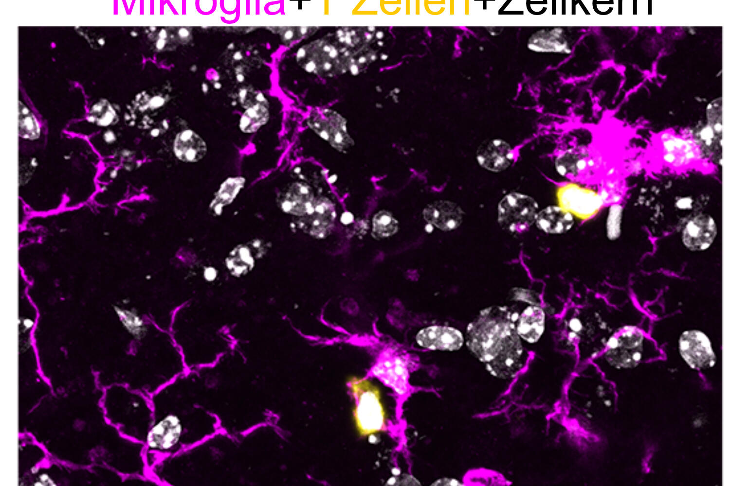 Microglia interacting with T cells in the central nervous system of SPG15-deficient mice